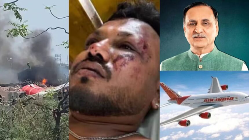 Ahmedabad Plane Crash: 242 में से 241 की दर्दनाक मौत, पूर्व मुख्यमंत्री विजय रूपाणी का भी निधन, सिर्फ एक यात्री बचा जिंदा