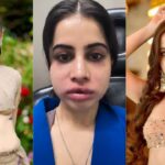 Urfi Javed: उर्फी जावेद ने हटवाए लिप फिलर, अस्पताल से शेयर किया दर्दनाक VIDEO – कहा "यह कोई फिल्टर नहीं है"