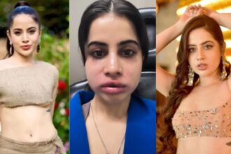 Urfi Javed: उर्फी जावेद ने हटवाए लिप फिलर, अस्पताल से शेयर किया दर्दनाक VIDEO – कहा "यह कोई फिल्टर नहीं है"