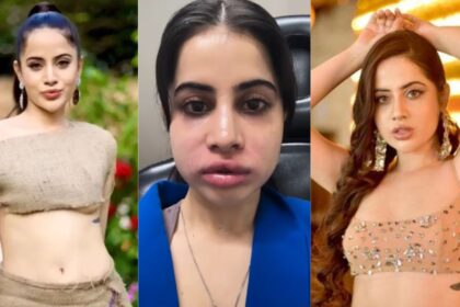 Urfi Javed: उर्फी जावेद ने हटवाए लिप फिलर, अस्पताल से शेयर किया दर्दनाक VIDEO – कहा "यह कोई फिल्टर नहीं है"