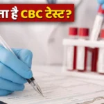 CBC Test क्या है? जानें RBC, WBC और Hemoglobin का मतलब और क्यों है यह जरूरी
