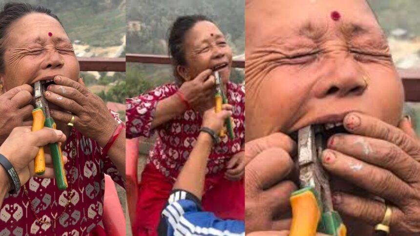 Viral News : बिना एनेस्थीसिया महिला ने प्लास से निकालवाया दांत, Viral Video देख लोग रह गए हैरान